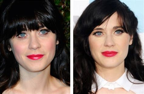 Zooey Deschanel Plastic Surgery Before & After